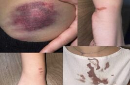 Studenti Poljoprivrednog u Beogradu: Koleginicu mučila policija